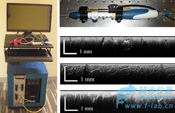 手持式扫描光学相干断层扫描活检系统_OCT光学活检仪器可对间质组织光学成像活检-辅光仪器