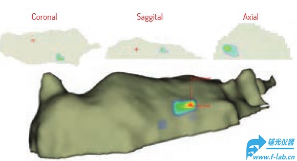 小鼠活体成像系统结果1