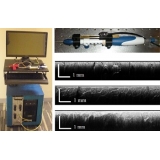 手持式扫描光学相干断层扫描活检系统_OCT光学活检仪器可对间质组织光学成像活检-辅光仪器